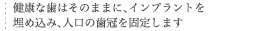 健康な歯はそのままに、インプラントを埋め込み、人口の歯冠を固定します